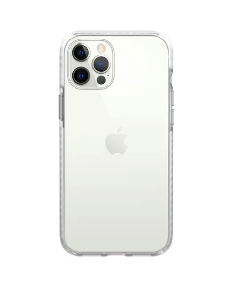 bailey iPhone Case